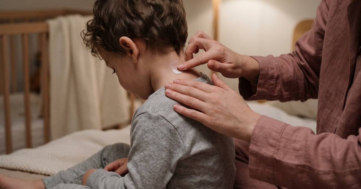 Dermatitis atópica: el costo de sostener un tratamiento crónico se vuelve una barrera para casi la mitad de los pacientes