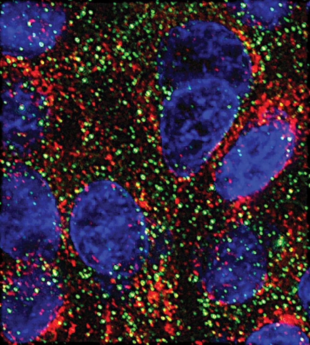 MicroARN pancreatic cancer 